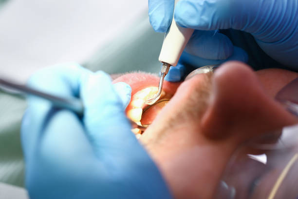 Best Tooth Infection Emergency Dentist  in Summit, NJ